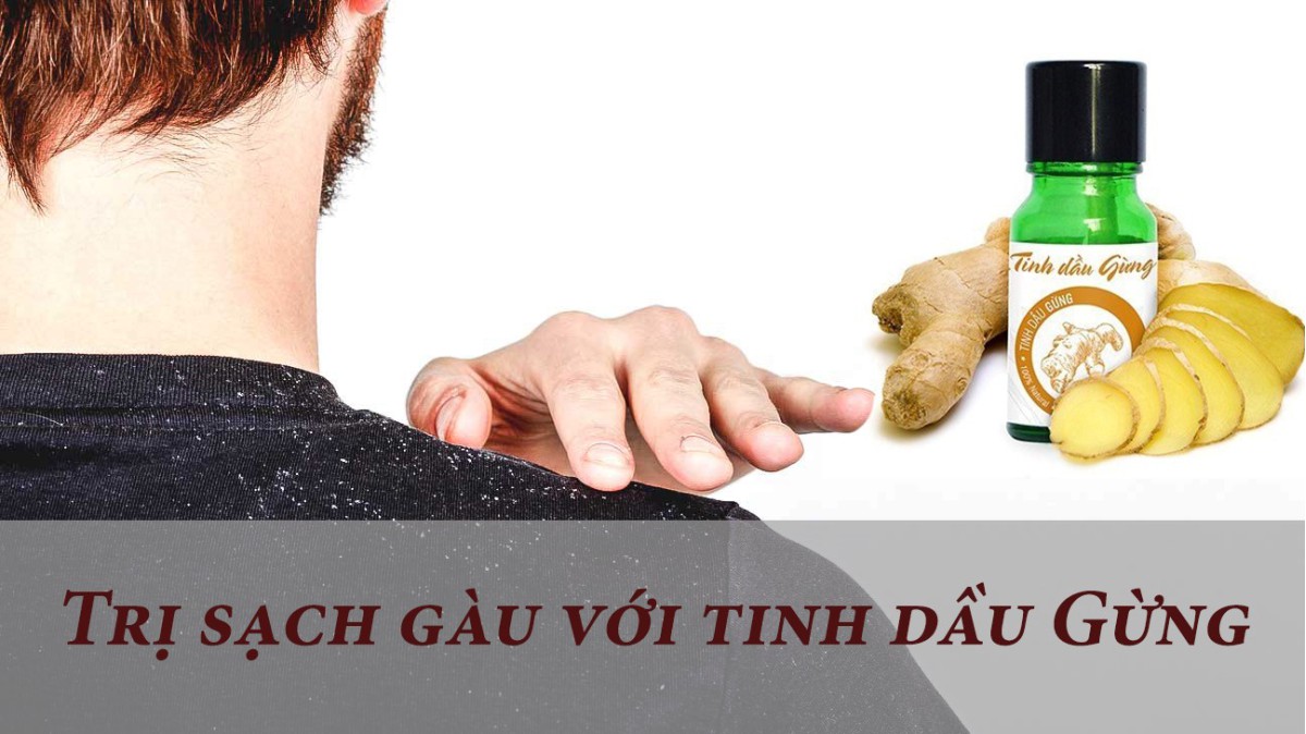 Dùng tinh dầu Gừng trị gàu hiệu quả