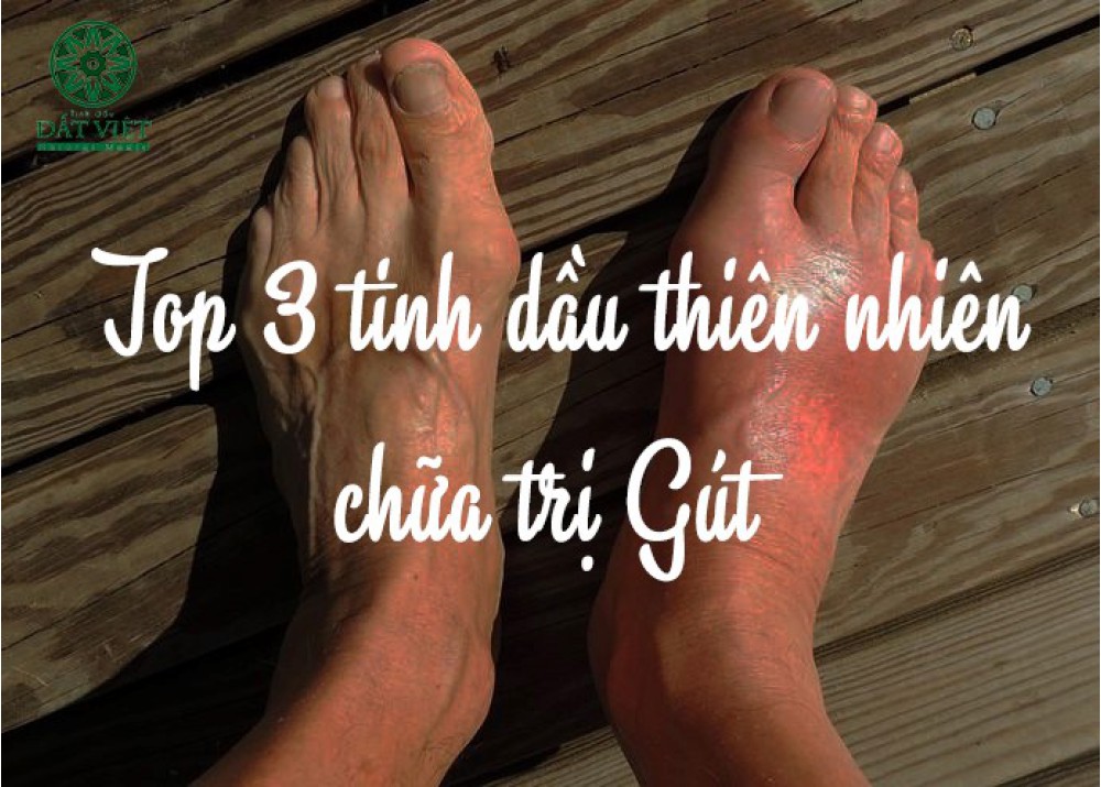 Trị Gout bằng tinh dầu thiên nhiên