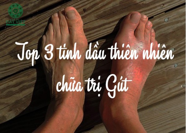 Trị Gout bằng tinh dầu thiên nhiên