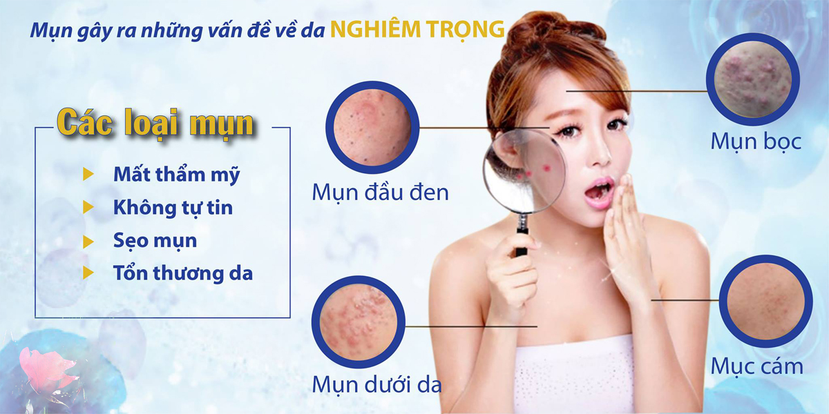 Trị mụn bằng tinh dầu có thật sự tốt cho da